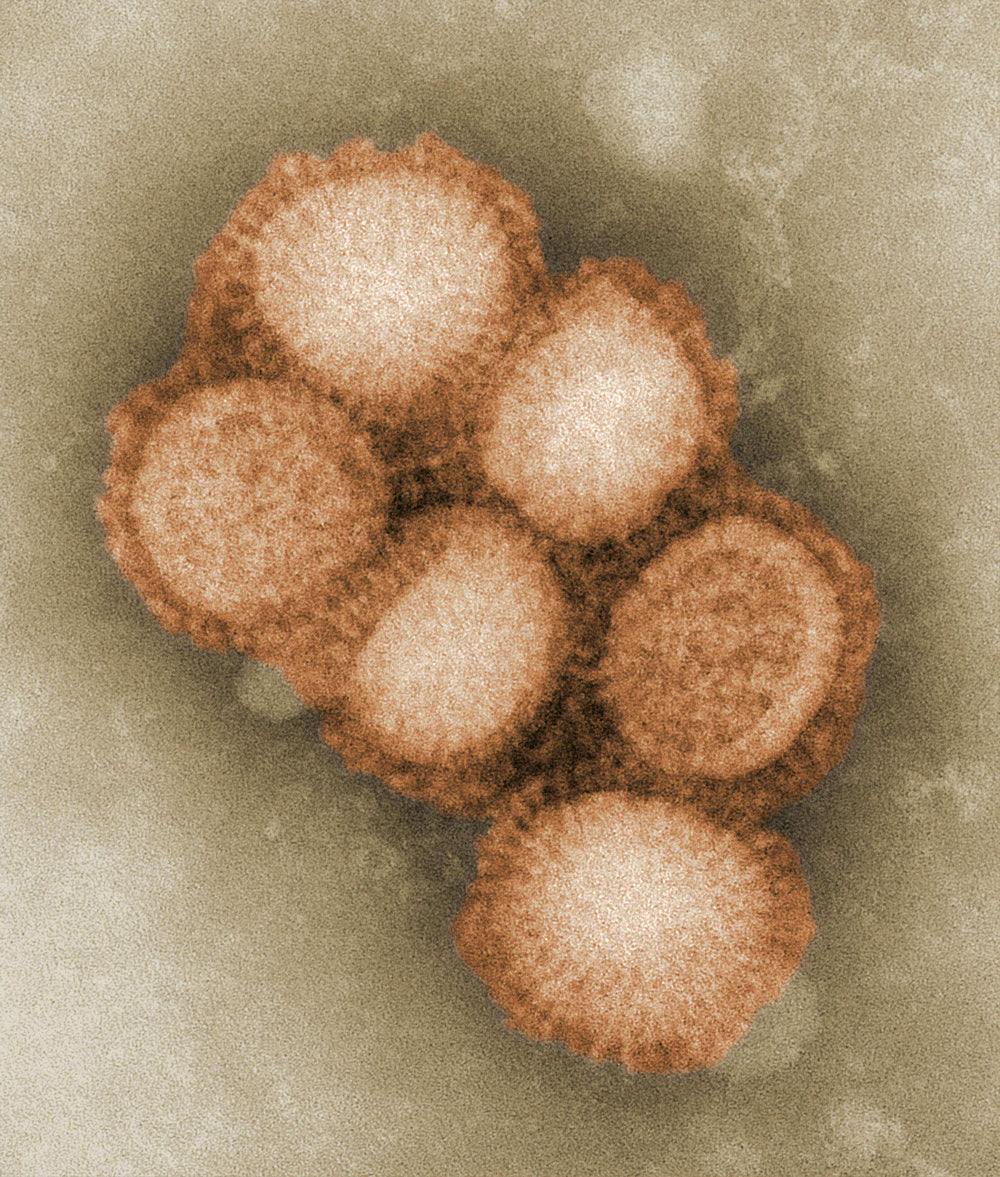 Parasite and Mold Testing